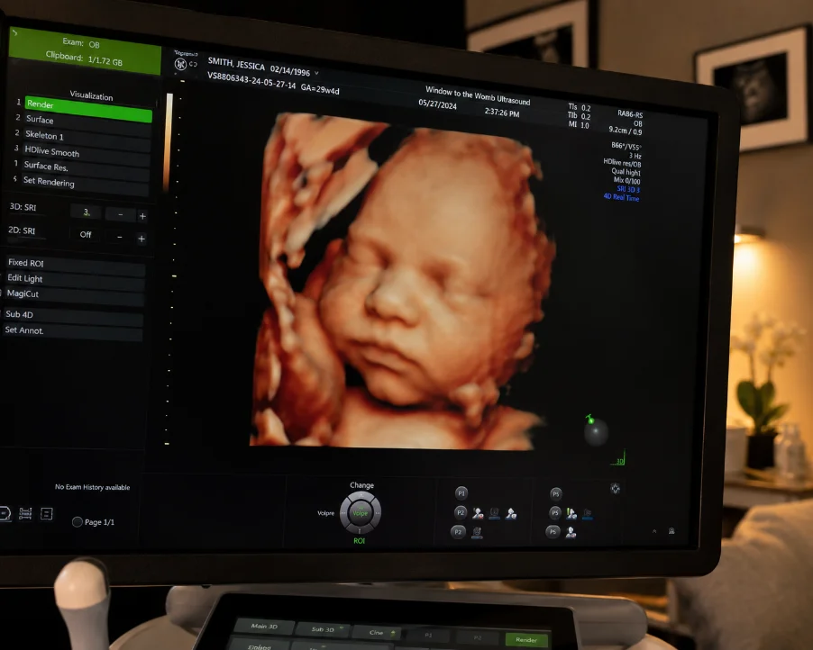 HD live 4D ultrasound render on the studio monitor